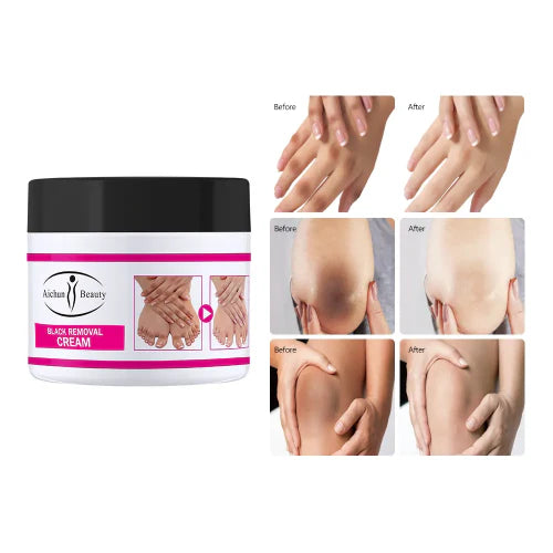 CREMA BLANQUEADORA DE ARTICULACIONES PARA ELIMINAR MANCHAS, RODILLAS Y CODOS OSCUROS